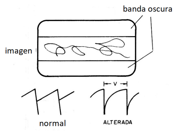 Figura 17 - Pérdida de la altura por la deformación y pérdida de la amplitud de la señal vertical
